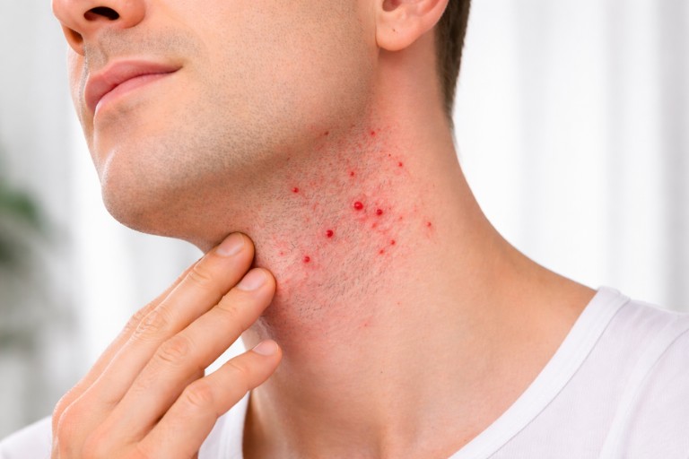 fuenf-fehler-rasur-blog